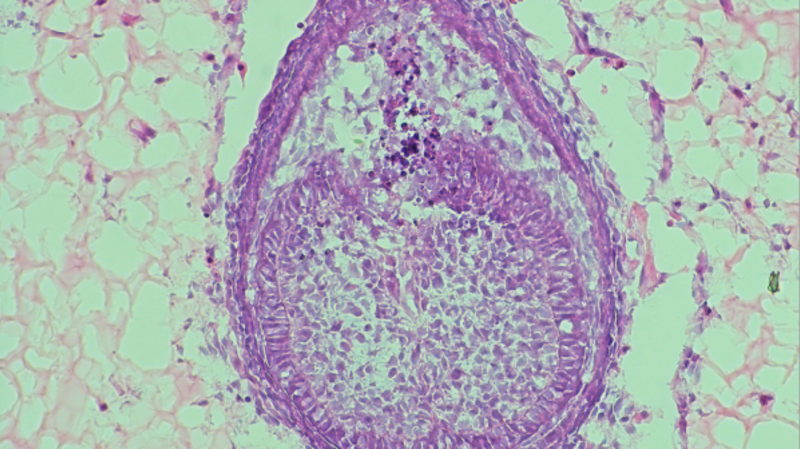 Researchers are working quickly to develop human teeth in the laboratory.