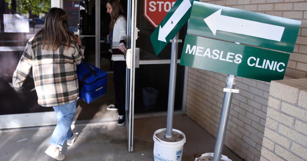South Carolina Reports Measles Outbreak as U.S. Cases Reach Highest Level in 25 Years
