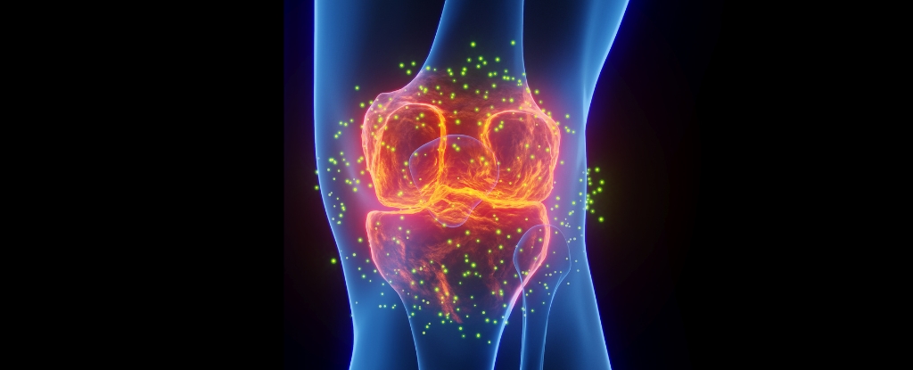 The Most Effective Treatment for Joint Pain May Not Be What You Expect, Expert States