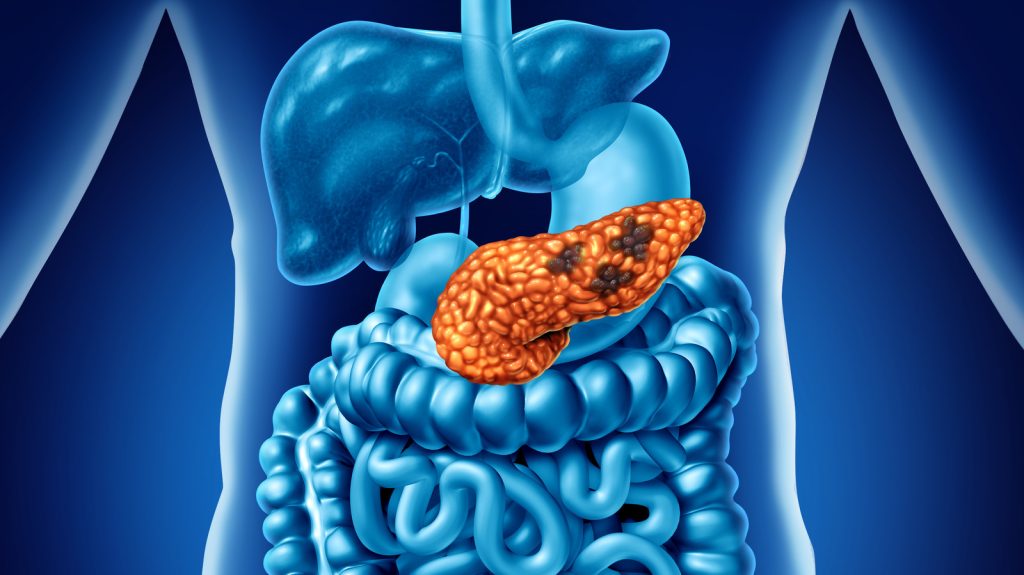 The Route Leading to the Spread of Pancreatic Cancer Has Been Found, Here’s What It Implies