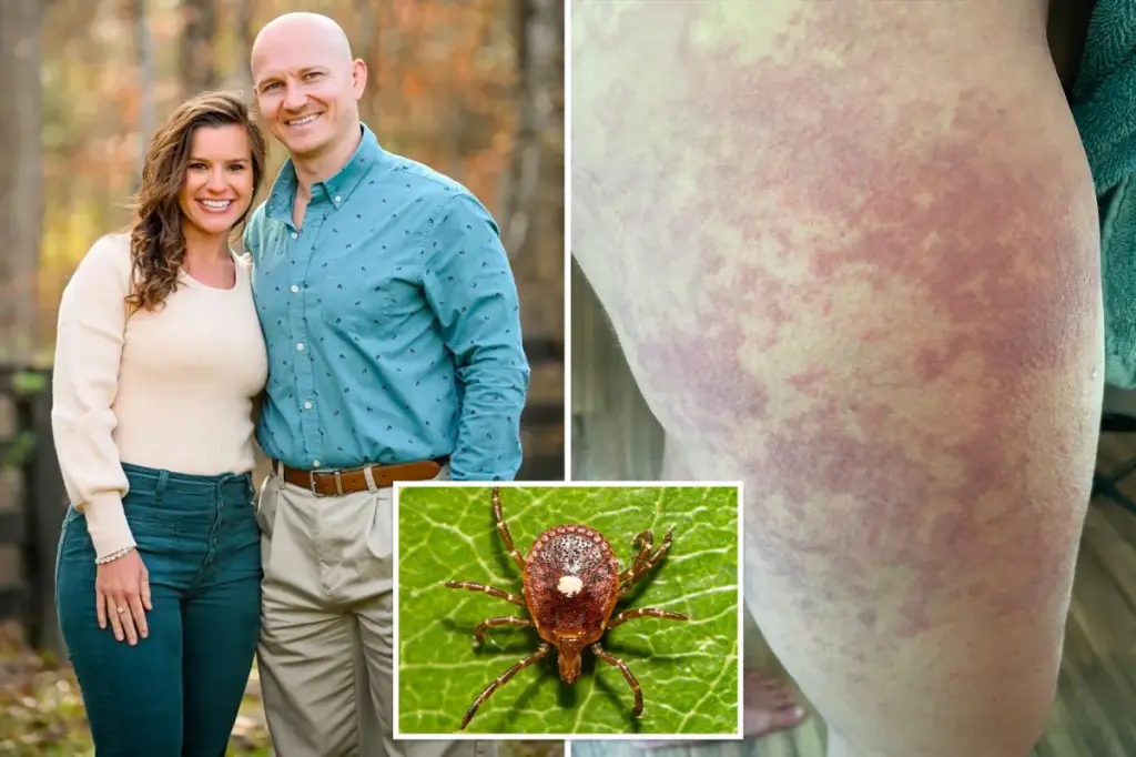A tick bite caused alpha-gal syndrome, making me allergic to meat — my life is unbearable.