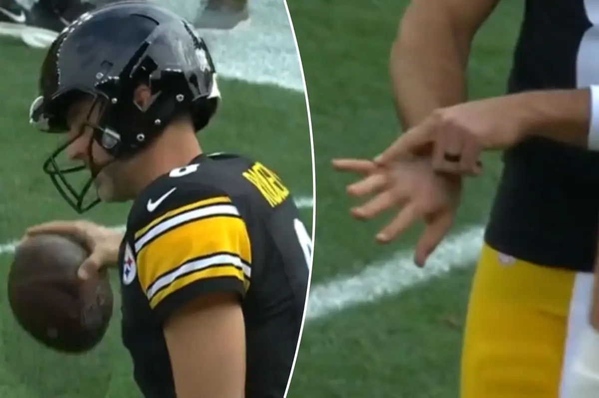 Aaron Rodgers appears to have a hand injury ahead of the Steelers vs. Colts game.
