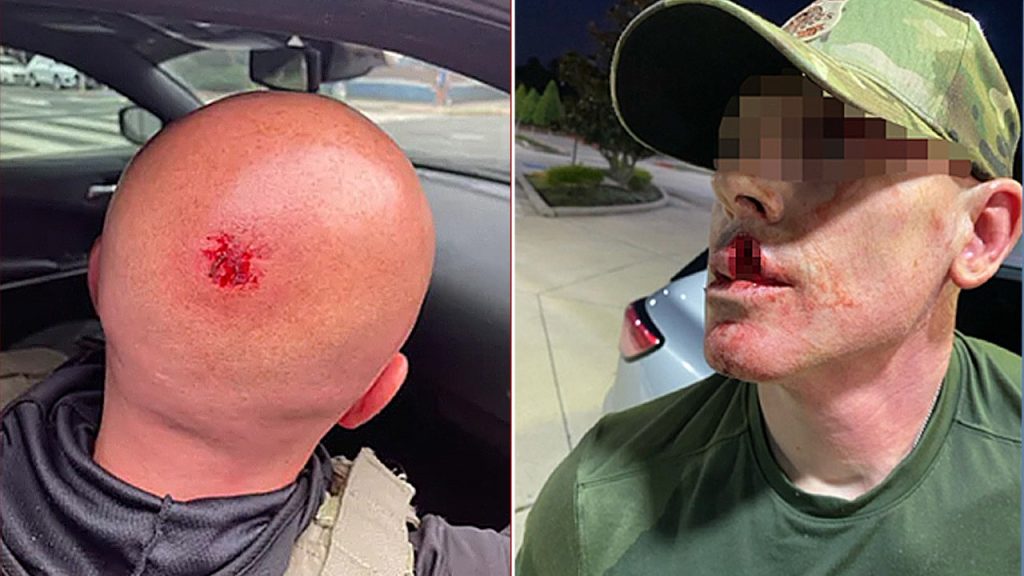 Assaults by ICE officers increase by 1,150% during Trump administration, according to DHS findings