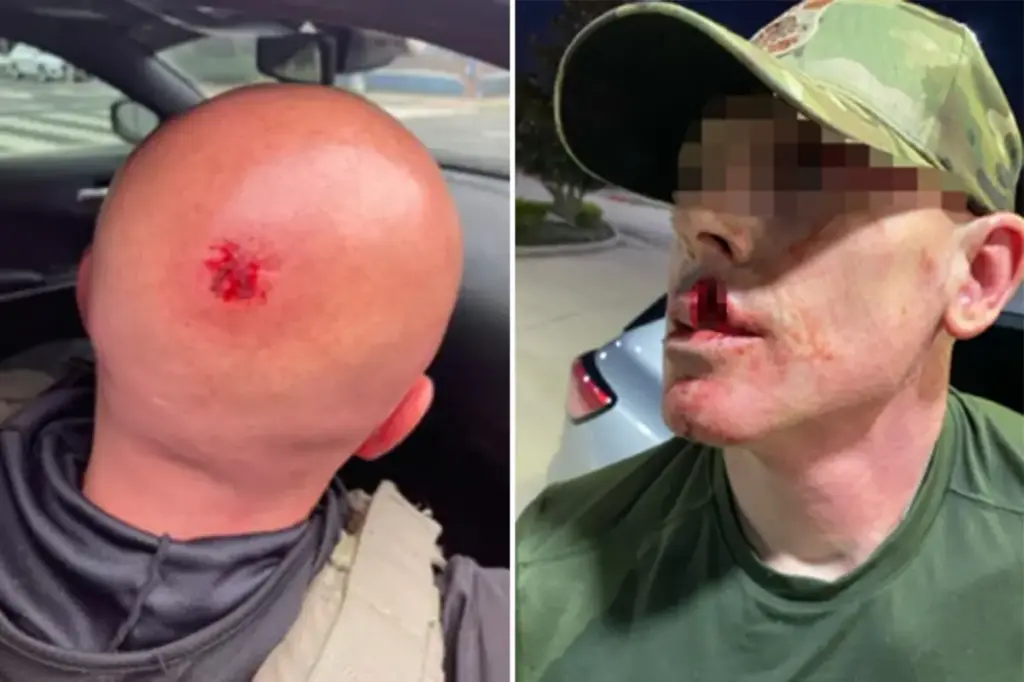 Assaults on ICE agents have surged by 1,150% since Trump began his presidency.