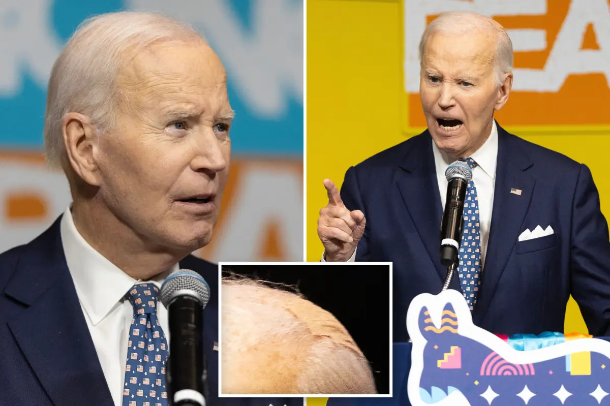Biden, with his injuries, states that his son Beau 'would have made a better president than I did' while criticizing Trump.