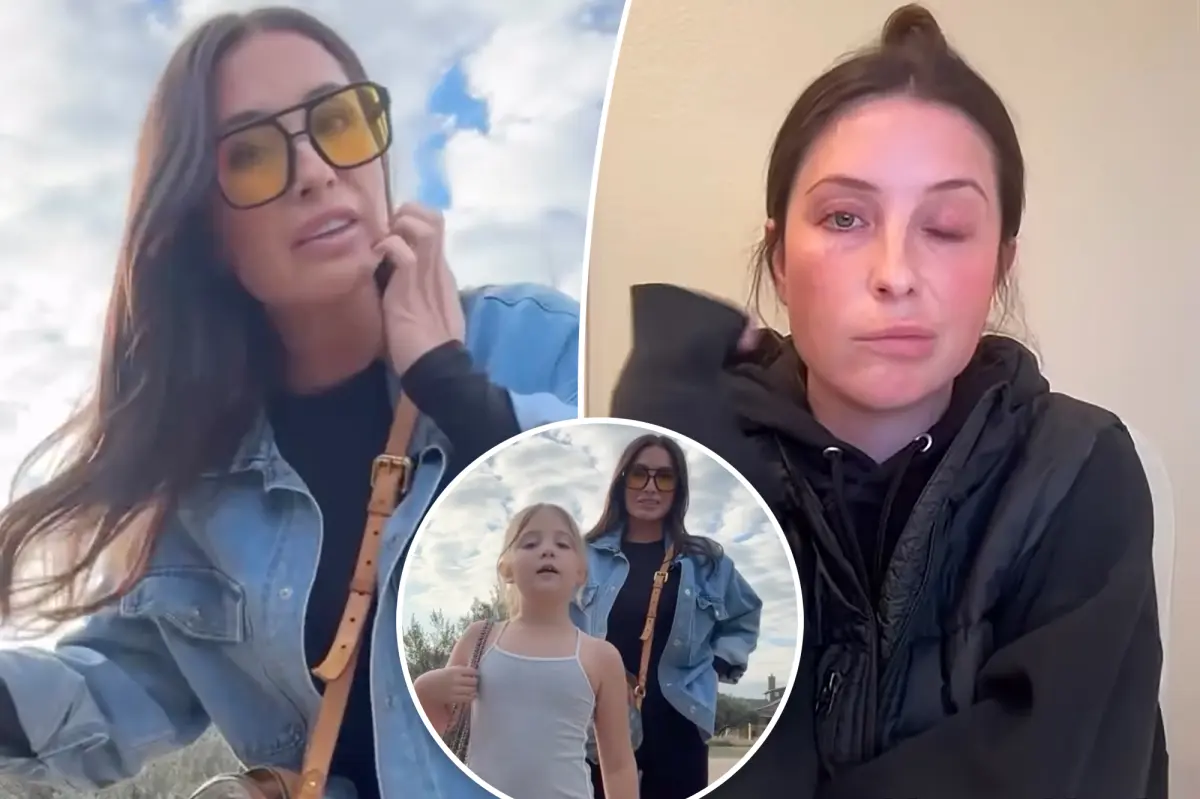 Bristol Palin shares discouraging news about her facial paralysis