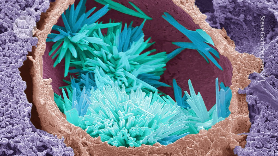 Can gene editing stop heart disease?