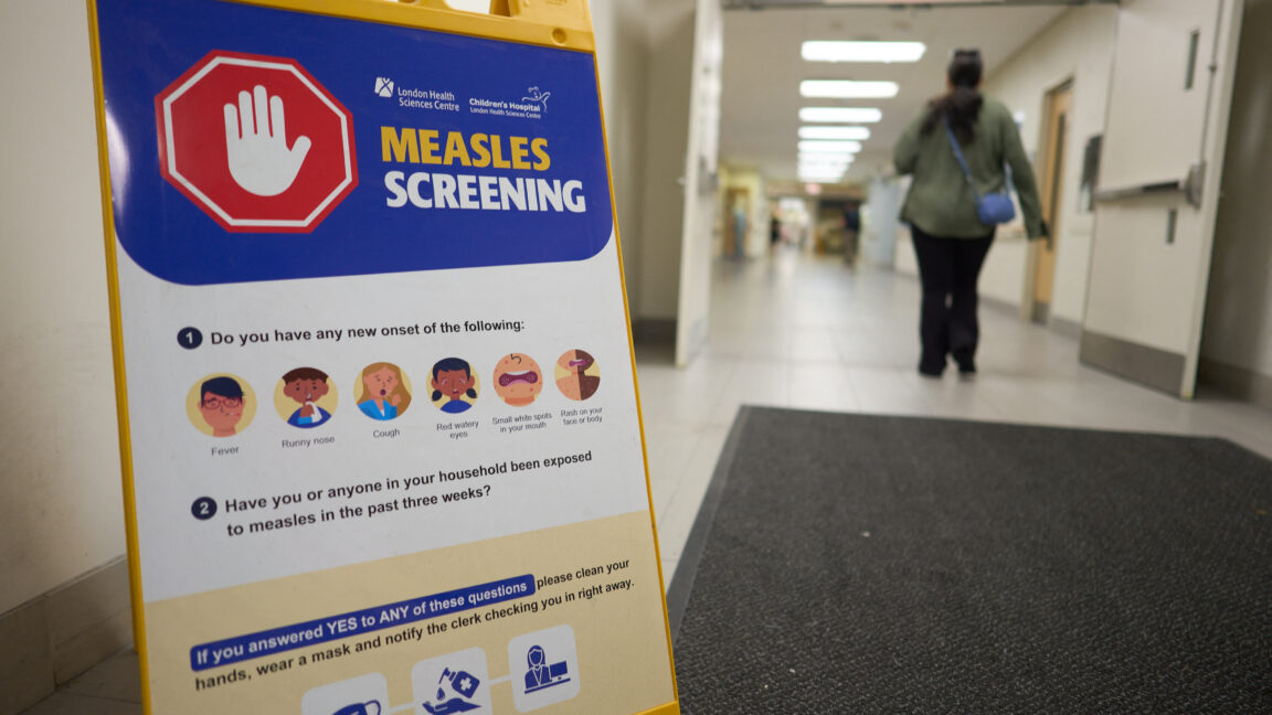 Canada battled measles, but the virus has now become endemic after being eliminated in 1998.