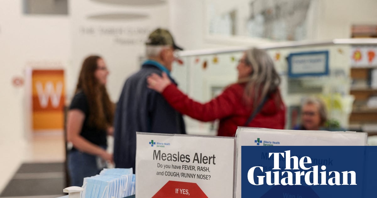 Canada's status as measles-free ends as outbreaks increase