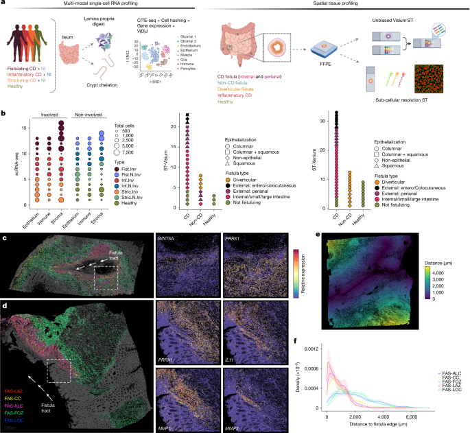 Fibroblast spaces shape Crohn’s fistulae