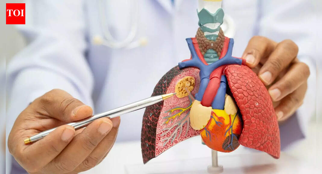 First-ever trial of a lung cancer prevention vaccine backed by £2.06 million to prevent cancer before it develops