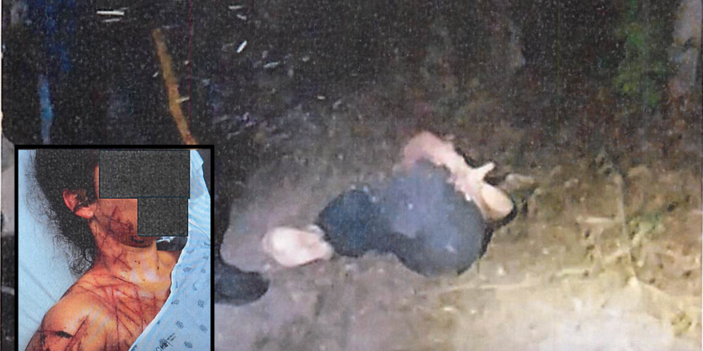 Former GOP aide discovered bound with severe injuries and 'Trump whore' marked on her abdomen — authorities claim it was staged.