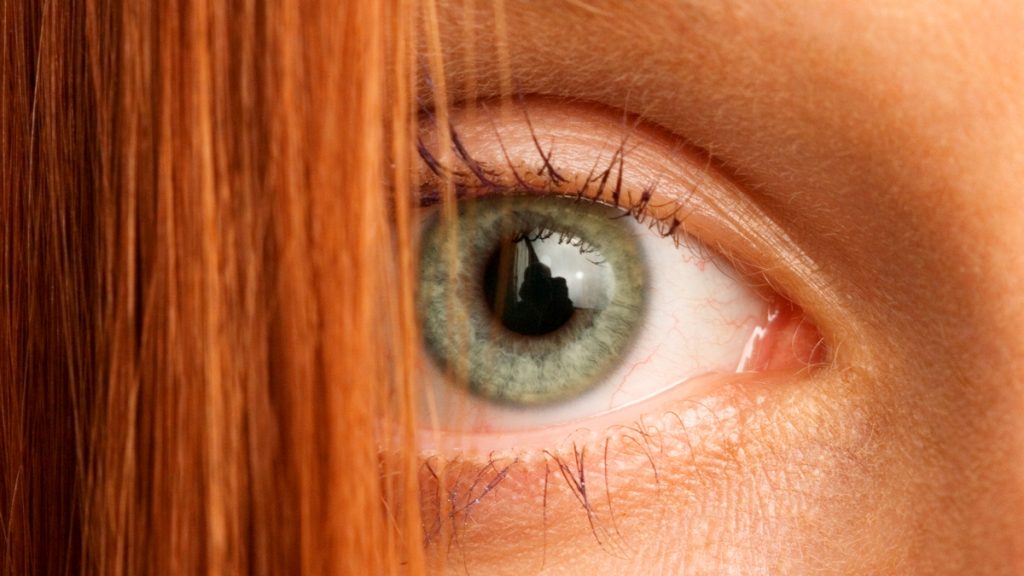 Gene for Red Hair May Reveal Why Certain Wounds Don't Heal