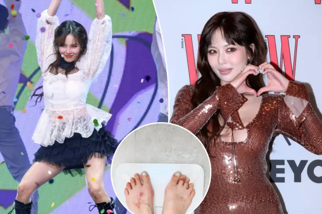 K-pop singer HyunA faints during a performance, raising worries about her recent weight loss.