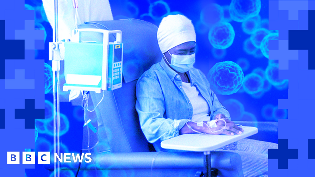 Most NHS hospitals are falling short of cancer targets