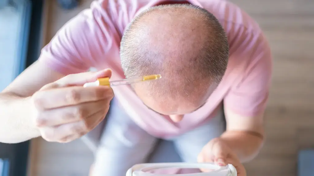 New hair loss treatment may help regrow hair in 20 days with serum application