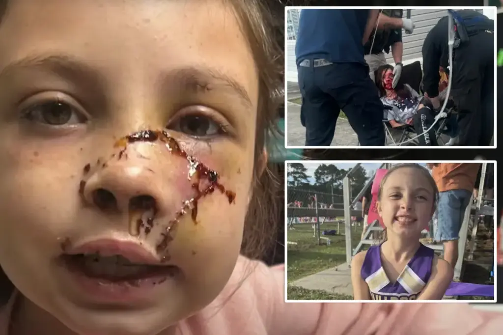 Nine-year-old Alabama girl attacked by dog, resulting in severe facial injuries