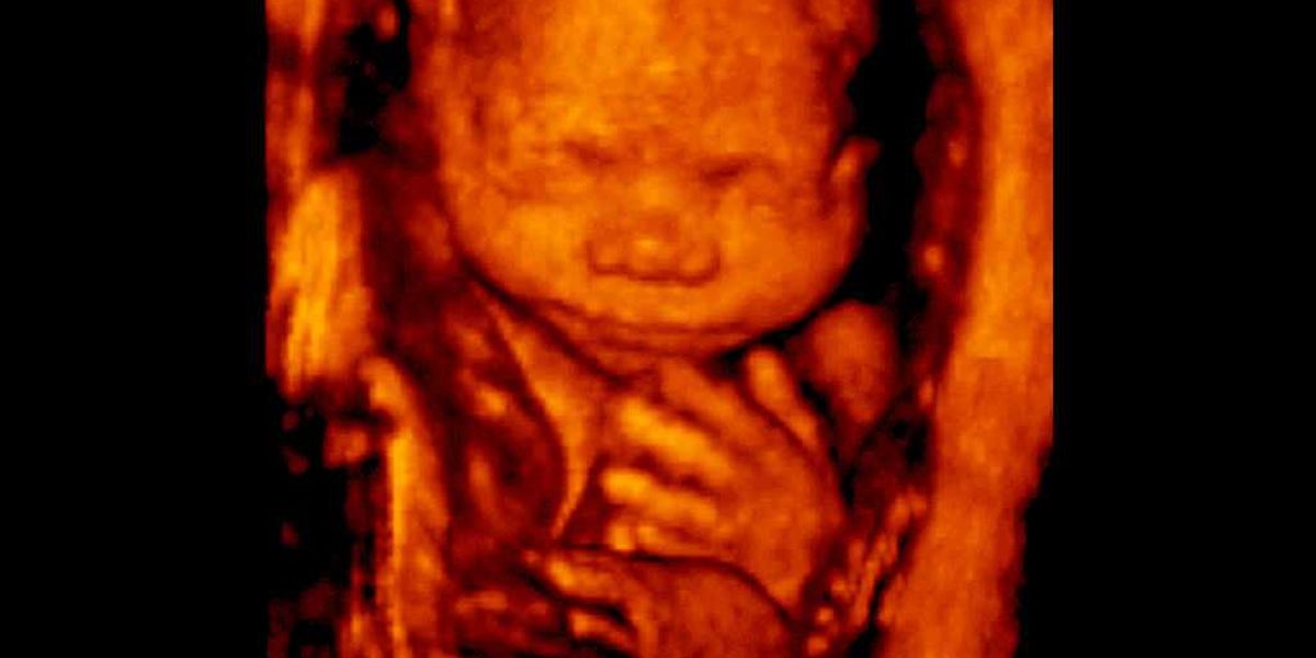 North Dakota Supreme Court reverses decision by lower court: Pro-life ban restored after efforts to halt the law