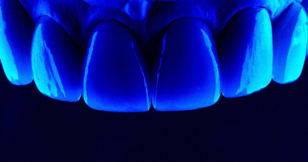 Researchers Claim They Have Found a Method to Regenerate Tooth Enamel