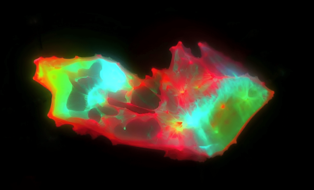 Researchers Have Discovered Fascinating Structures in COVID Blood Samples