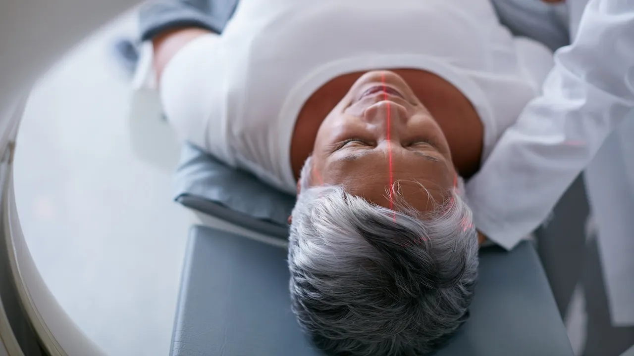 Researchers find method to dissolve protein clusters before Alzheimer's begins