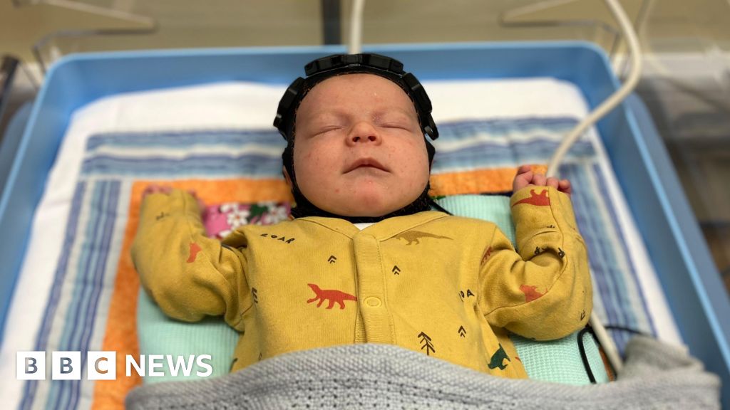 Swimming cap from Cambridge offers hope for babies with brain injuries