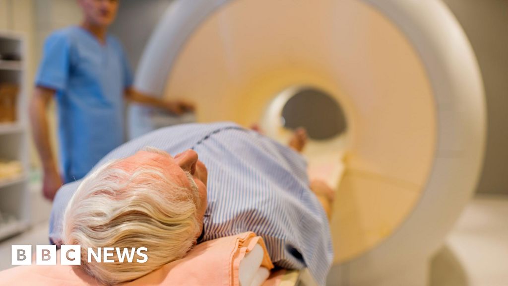 Trial for prostate cancer screening to enroll thousands of men