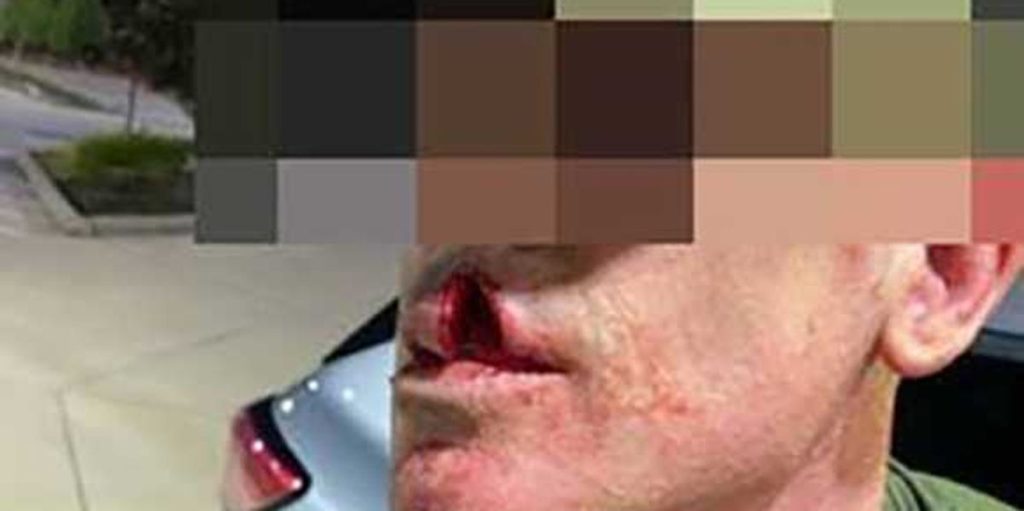 Undocumented individual accused of 'physically assaulting' ICE agent during immigration operation: DHS