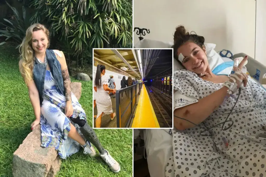 Woman who потеряла arm and leg in subway accident receives $82 million