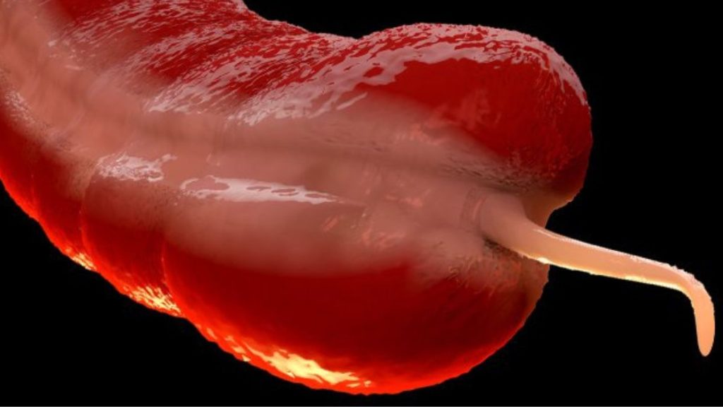 An Uncommon Cancer is Increasing Among Young People, and Experts Are Confused