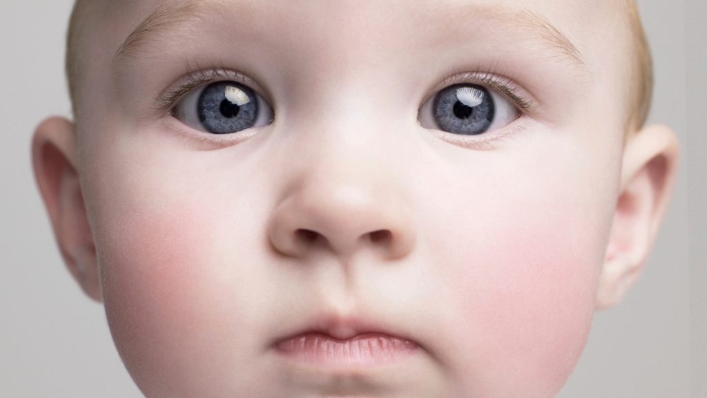 Experts Discover That Dementia Has Roots in Childhood