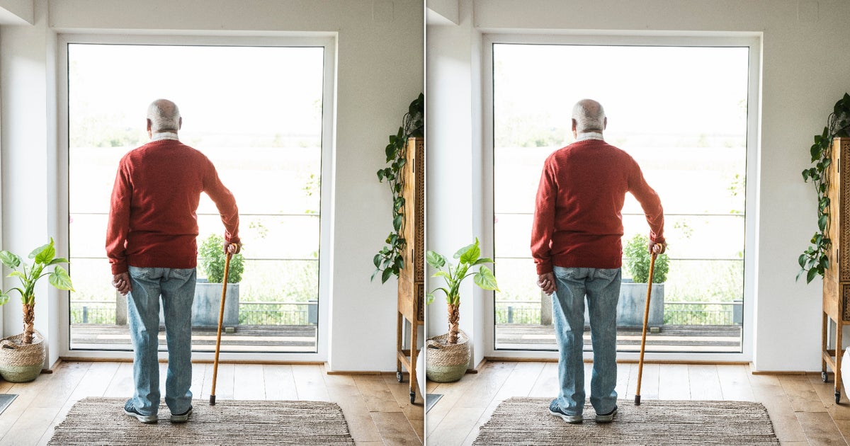 Frequent Physical Indicators of Dementia