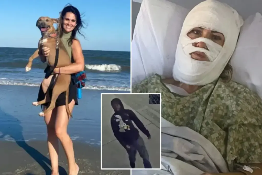 Georgia woman Ashley Wasielewski sustained serious burns from being splashed with a harmful chemical in an unprovoked park assault.