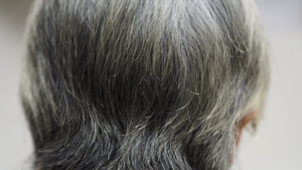 Gray hair could have developed as a defense against cancer, research suggests.