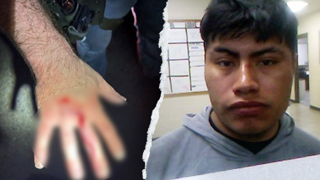 ICE officer bitten on the hand by undocumented immigrant during arrest in Louisiana