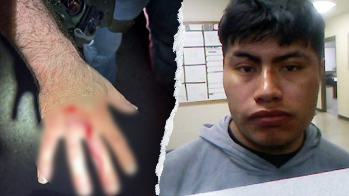 ICE officer bitten on the hand by undocumented immigrant during arrest in Louisiana