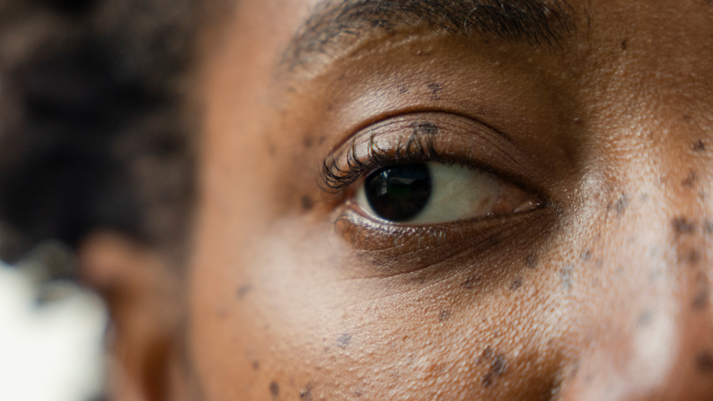 Injecting anesthetic into a "lazy eye" might fix it, initial research indicates