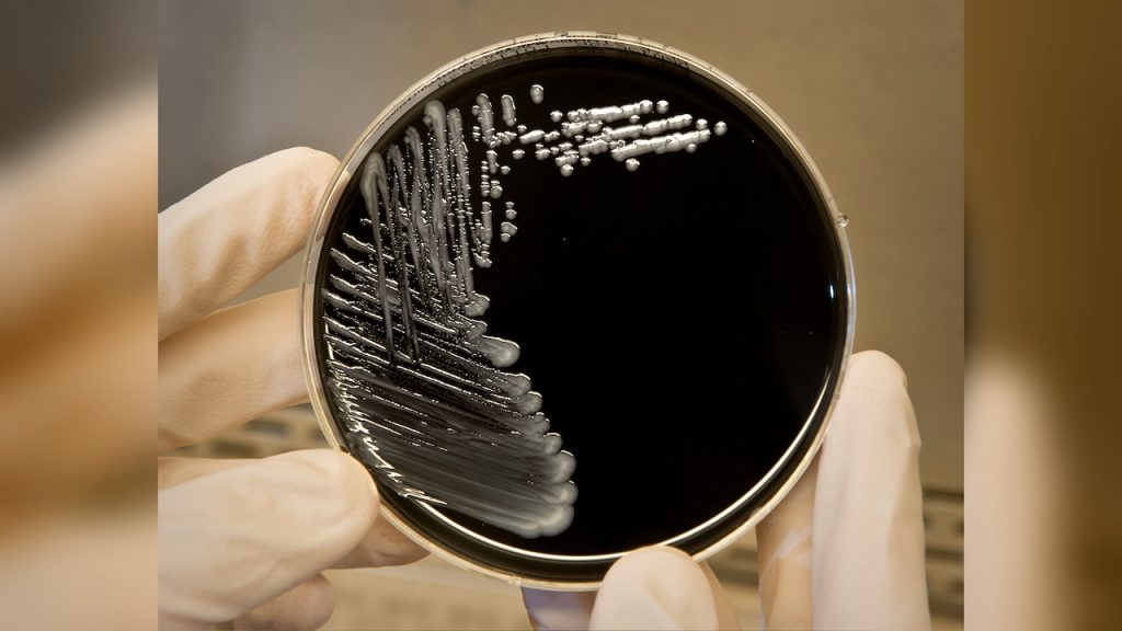 Legionnaires' disease discovered in hospital water system in New Jersey following patient death