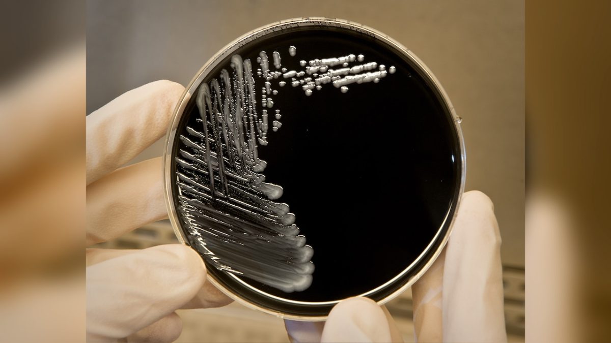 Legionnaires' disease discovered in hospital water system in New Jersey following patient death