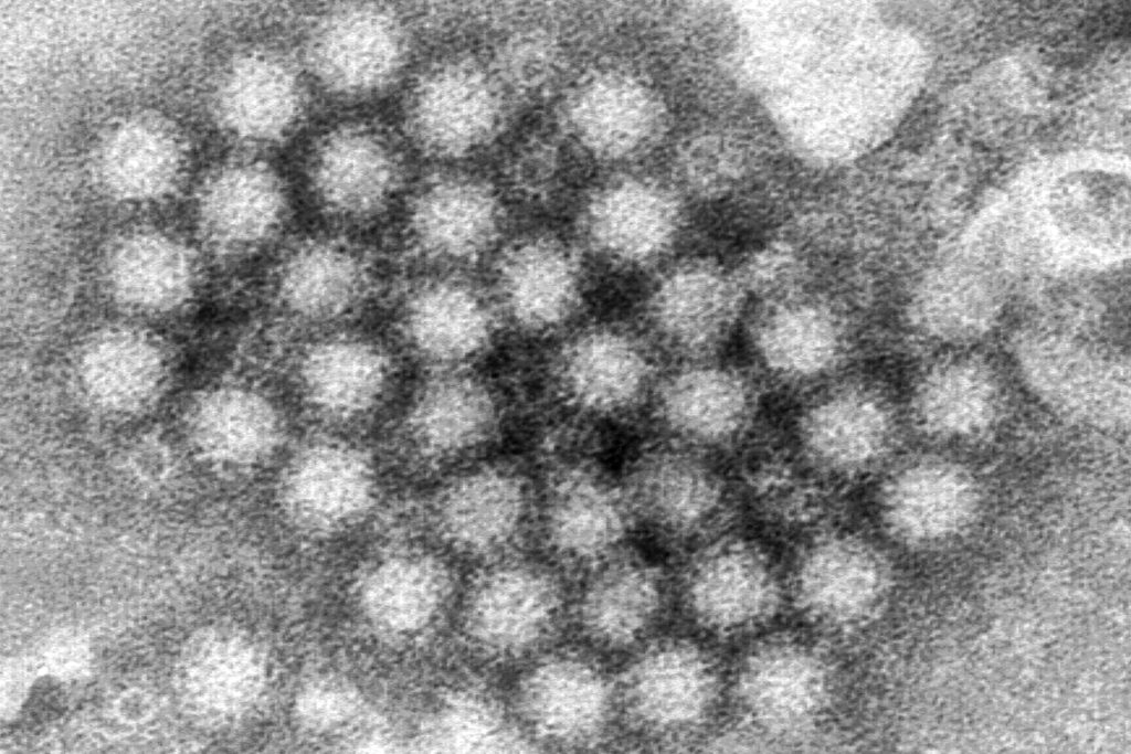 Medford school remains closed for a second day due to norovirus outbreak