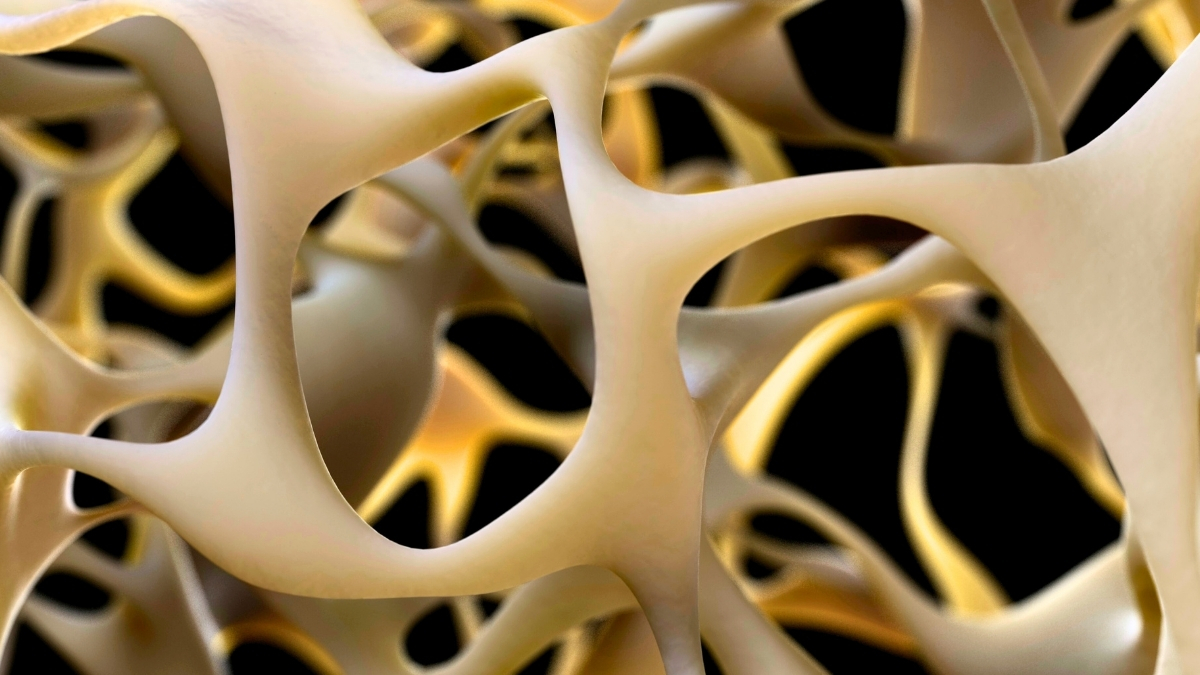 New Advancement in Bone Strengthening May Reverse Osteoporosis