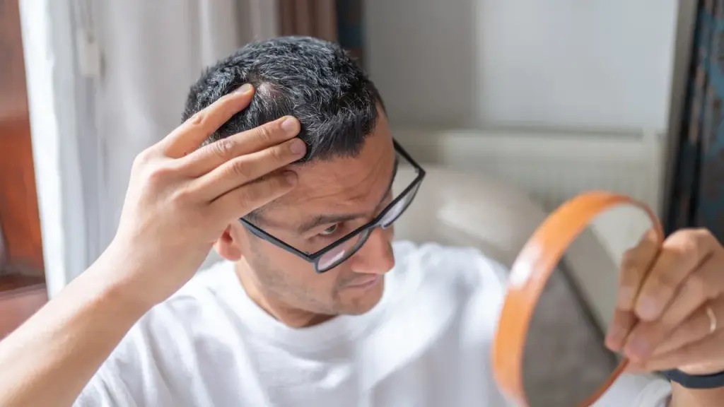 New hair loss therapy demonstrates notable progress compared to the placebo.