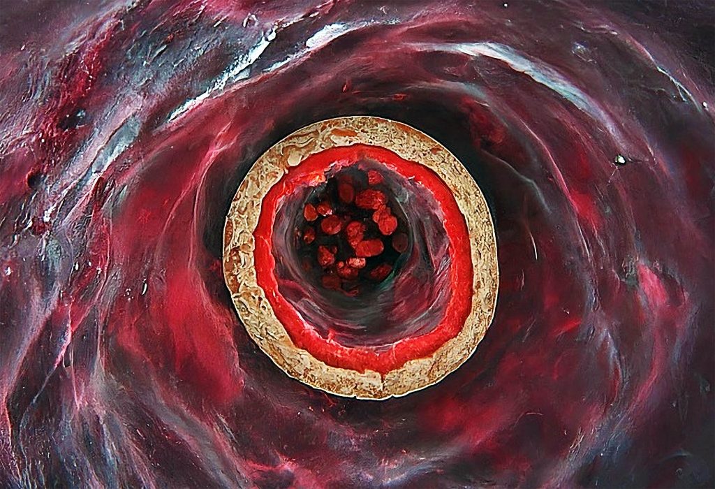 Photos taken within arteries show an unprecedented discovery.