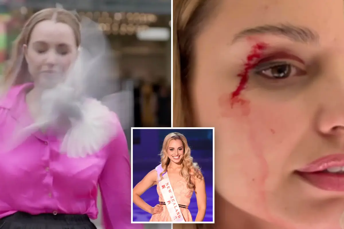 Reporter in New Zealand injured by a bird, resulting in bloodshed