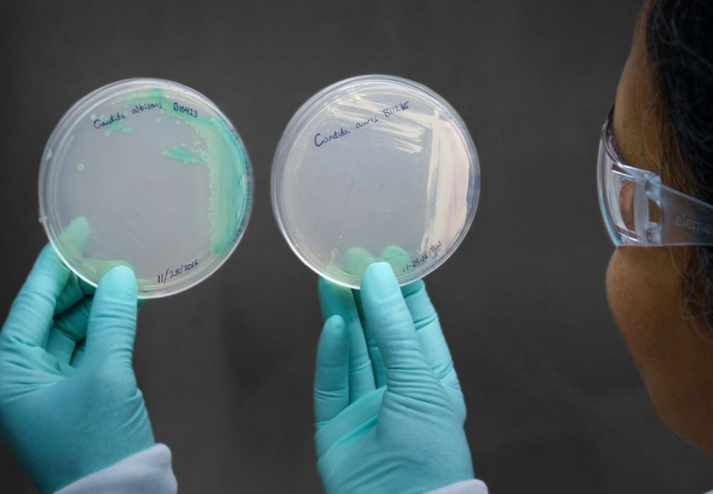 Superbug spreads to 28 states, such as Alabama: Tracking the dangerous fungus's reach