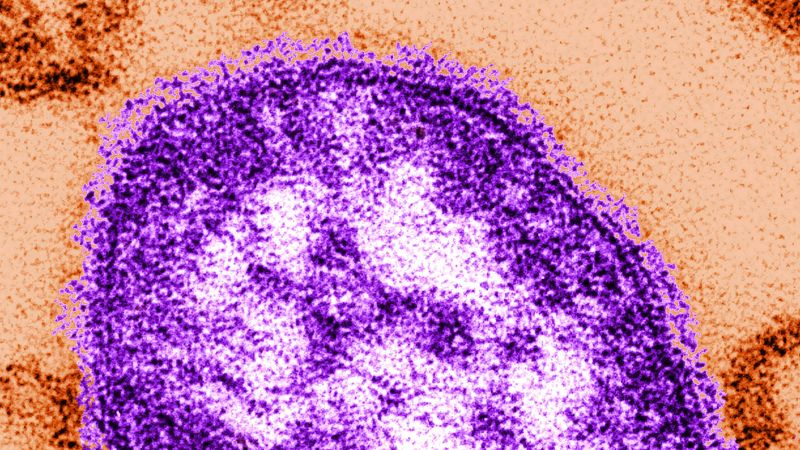 A measles outbreak spreads in South Carolina due to low vaccination rates.