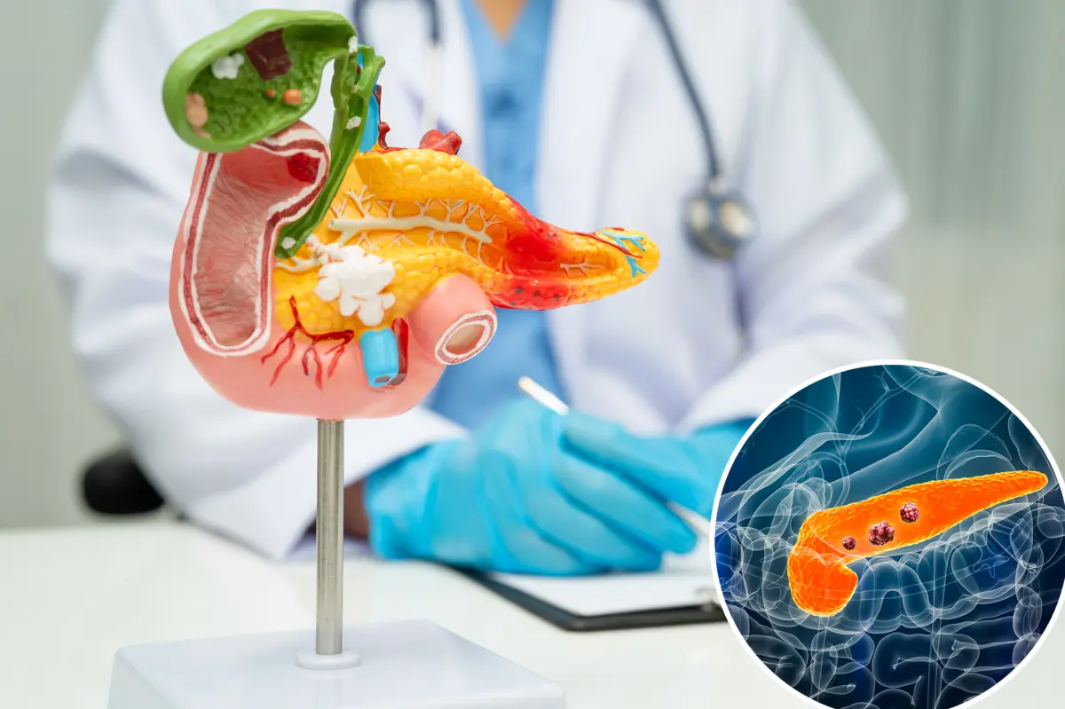 Advancement in pancreatic cancer research: tumors vanish in mice