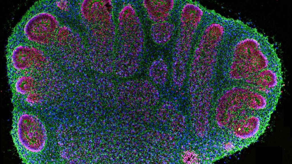 Brain organoids assist researchers but pose ethical concerns