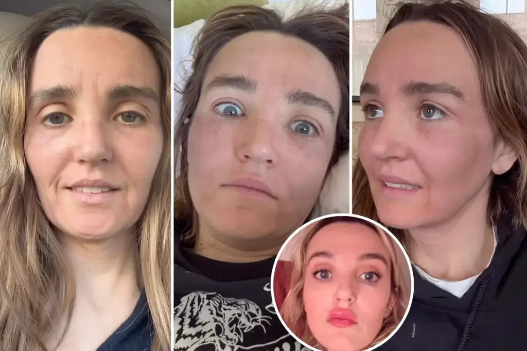 Chloe Fineman reveals images of a 'failed' cosmetic treatment