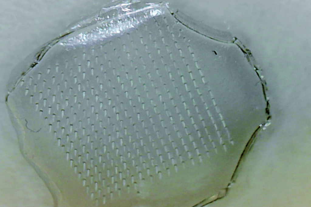 Combatting Food Poisoning with a Patch